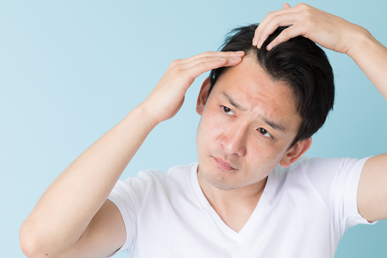 壮年期脱毛症(AGA)に対するPRP治療